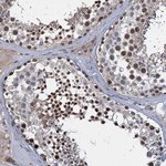 CCDC184 Polyclonal Antibody, Invitrogen™