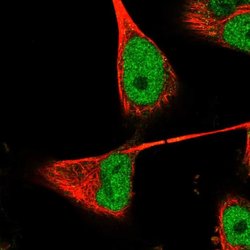 RNaseH2B Rabbit anti-Human, Polyclonal, Invitrogen 100 &mu;L; Unconjugated:Antibodies,