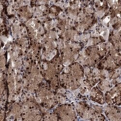 RNaseH2B Rabbit anti-Human, Polyclonal, Invitrogen 100 &mu;L; Unconjugated:Antibodies,