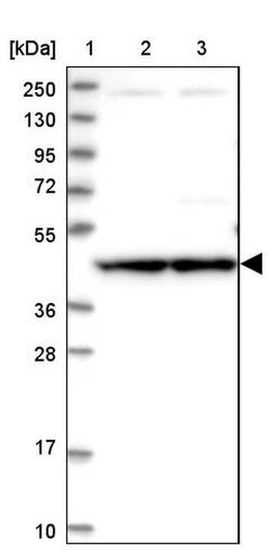 CCBE1, Polyclonal, Invitrogen 100&mu;L; Unconjugated:Antibodies, Polyclonal
