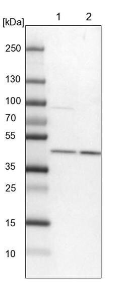 CCBE1, Polyclonal, Invitrogen 100&mu;L; Unconjugated:Antibodies, Polyclonal
