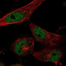 CLCN7 Polyclonal Antibody, Invitrogen 100 &mu;L; Unconjugated:Antibodies,