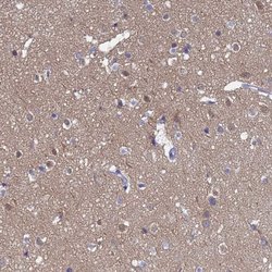 TUBB2B, Polyclonal, Invitrogen 100&mu;L; Unconjugated:Antibodies, Polyclonal