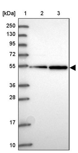 TUBB2B, Polyclonal, Invitrogen 100&mu;L; Unconjugated:Antibodies, Polyclonal