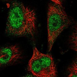 BICC1 Rabbit anti-Human, Polyclonal, Invitrogen 100 &mu;L; Unconjugated:Antibodies,