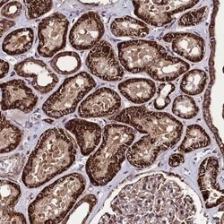 BICC1 Rabbit anti-Human, Polyclonal, Invitrogen 100 &mu;L; Unconjugated:Antibodies,
