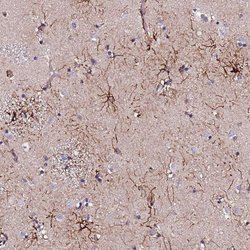 CT62 Rabbit anti-Human, Polyclonal, Invitrogen 100 &mu;L; Unconjugated:Antibodies,