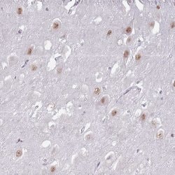 PTCHD1 Polyclonal Antibody, Invitrogen 100 &mu;L; Unconjugated:Antibodies,