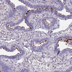 C3orf80 Polyclonal Antibody, Invitrogen 100 &mu;L; Unconjugated:Antibodies,