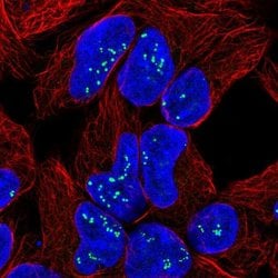 TPPP3 Polyclonal Antibody, Invitrogen 100 &mu;L; Unconjugated:Antibodies,