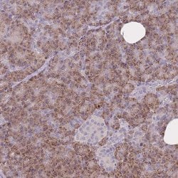 FRG2B Polyclonal Antibody, Invitrogen 100 &mu;L; Unconjugated:Antibodies,