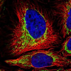 TOMM5 Polyclonal Antibody, Invitrogen 100 &mu;L; Unconjugated:Antibodies,