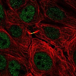 TMEM8A Polyclonal Antibody, Invitrogen 100 &mu;L; Unconjugated:Antibodies,