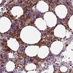 TMEM8A Polyclonal Antibody, Invitrogen 100 &mu;L; Unconjugated:Antibodies,