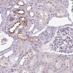 OR2AK2 Polyclonal Antibody, Invitrogen 100 &mu;L; Unconjugated:Antibodies,