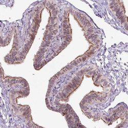 ICE1 Polyclonal Antibody, Invitrogen 100 &mu;L; Unconjugated:Antibodies,