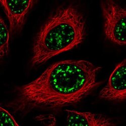 SMC5 Polyclonal Antibody, Invitrogen 100 &mu;L; Unconjugated:Antibodies,