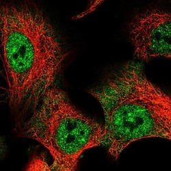 RBPMS Polyclonal Antibody, Invitrogen 100 &mu;L | Buy Online | Invitrogen | Fisher Scientific