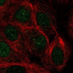 PR38A Polyclonal Antibody, Invitrogen 100 &mu;L; Unconjugated:Antibodies,