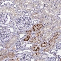 PR38A Polyclonal Antibody, Invitrogen 100 &mu;L; Unconjugated:Antibodies,