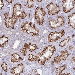 TP53I11 Polyclonal Antibody, Invitrogen™