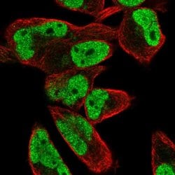 FEM1C Polyclonal Antibody, Invitrogen 100 &mu;L; Unconjugated:Antibodies,