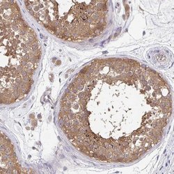FEM1C Polyclonal Antibody, Invitrogen 100 &mu;L; Unconjugated:Antibodies,