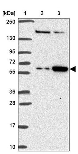 FEM1C Polyclonal Antibody, Invitrogen 100 &mu;L; Unconjugated:Antibodies,