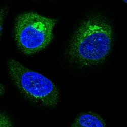 TP53I11 Polyclonal Antibody, Invitrogen™