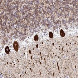 TP53I11 Polyclonal Antibody, Invitrogen&trade;