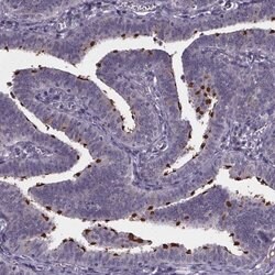 NPHP4 Polyclonal Antibody, Invitrogen 100 &mu;L; Unconjugated:Antibodies,