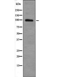 Phospho-TGFBR3 (Thr842) Polyclonal Antibody, Invitrogen 100 &mu;L; Unconjugated:Antibodies,