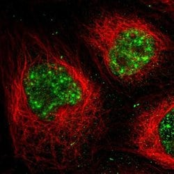 Invitrogen MPP1 Polyclonal Antibody 100 &mu;L; Unconjugated:Antibodies,