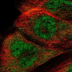 Invitrogen RTCB Polyclonal Antibody 100 &mu;L; Unconjugated:Antibodies,