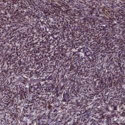 Invitrogen ZNF630 Polyclonal Antibody 100 &mu;L; Unconjugated:Antibodies,