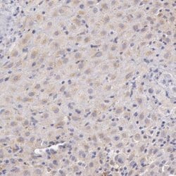 Invitrogen C1r Polyclonal Antibody 100 &mu;L; Unconjugated:Antibodies,