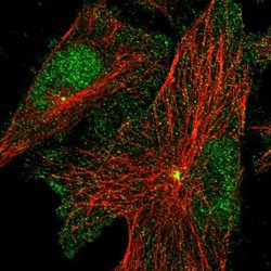 Invitrogen PRICKLE3 Polyclonal Antibody 100 &mu;L; Unconjugated:Antibodies,