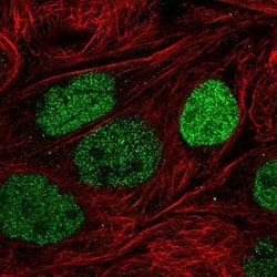 Invitrogen PSD3 Polyclonal Antibody 100 &mu;L; Unconjugated:Antibodies,
