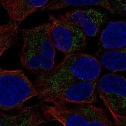 MCAT Polyclonal Antibody:Antibodies, Polyclonal
