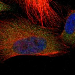 Invitrogen TROVE2 Polyclonal Antibody 100 &mu;L; Unconjugated:Antibodies,
