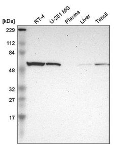 Invitrogen TROVE2 Polyclonal Antibody 100 &mu;L; Unconjugated:Antibodies,