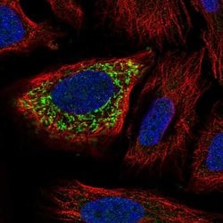 Invitrogen ZNF230 Polyclonal Antibody 100 &mu;L; Unconjugated:Antibodies,