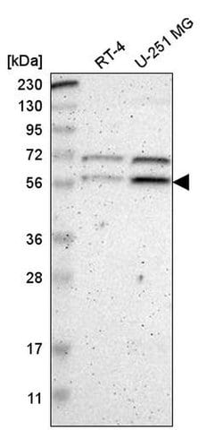 Invitrogen ZNF230 Polyclonal Antibody 100 &mu;L; Unconjugated:Antibodies,