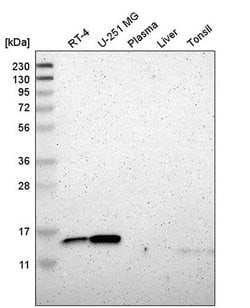 Invitrogen RPS12 Polyclonal Antibody 100 &mu;L; Unconjugated:Antibodies,