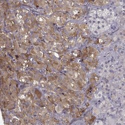 Invitrogen SLC18A1 Polyclonal Antibody 100 &mu;L | Buy Online | Invitrogen&trade; | Fisher Scientific