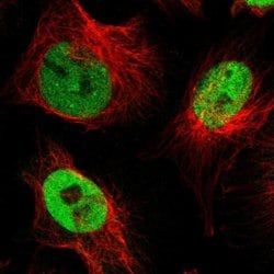 Invitrogen NFIX Polyclonal Antibody 100 &mu;L; Unconjugated:Antibodies,