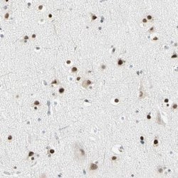 Invitrogen IMPG2 Polyclonal Antibody 100 &mu;L; Unconjugated:Antibodies,