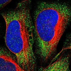 ALOX15B Polyclonal Antibody, Invitrogen 100 &mu;L | Buy Online | Thermo Scientific | Fisher Scientific