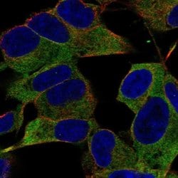 Invitrogen IGSF9B Polyclonal Antibody 100 &mu;L; Unconjugated:Antibodies,