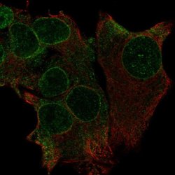Invitrogen TRAK1 Polyclonal Antibody 100 &mu;L; Unconjugated:Antibodies,